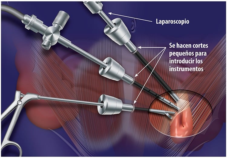cirugía ambulatoria Dr. Jesús Martínez Hoed