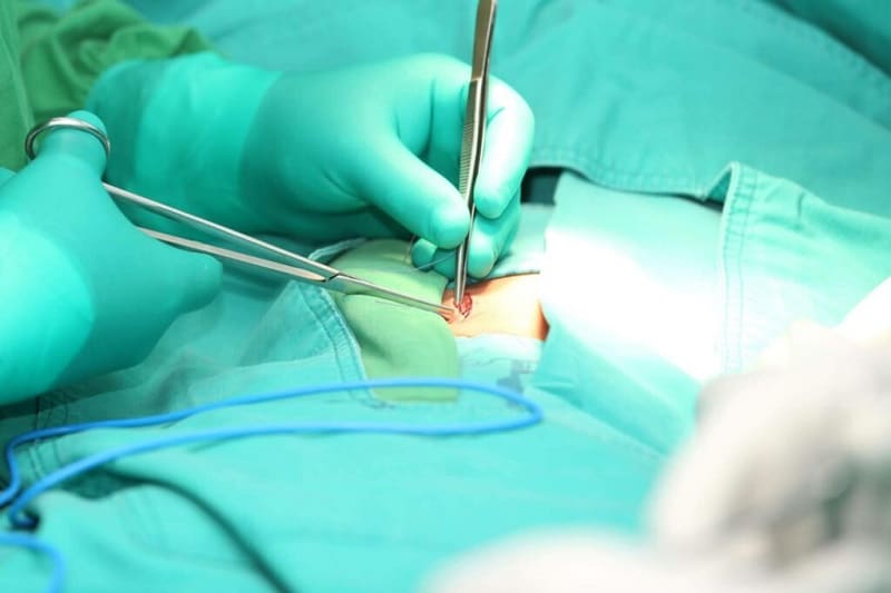 ¿Qué es la hernia postincisional? | Dr. Jesús Martínez Hoed ¿Qué es la hernia postincisional? | Dr. Jesús Martínez Hoed