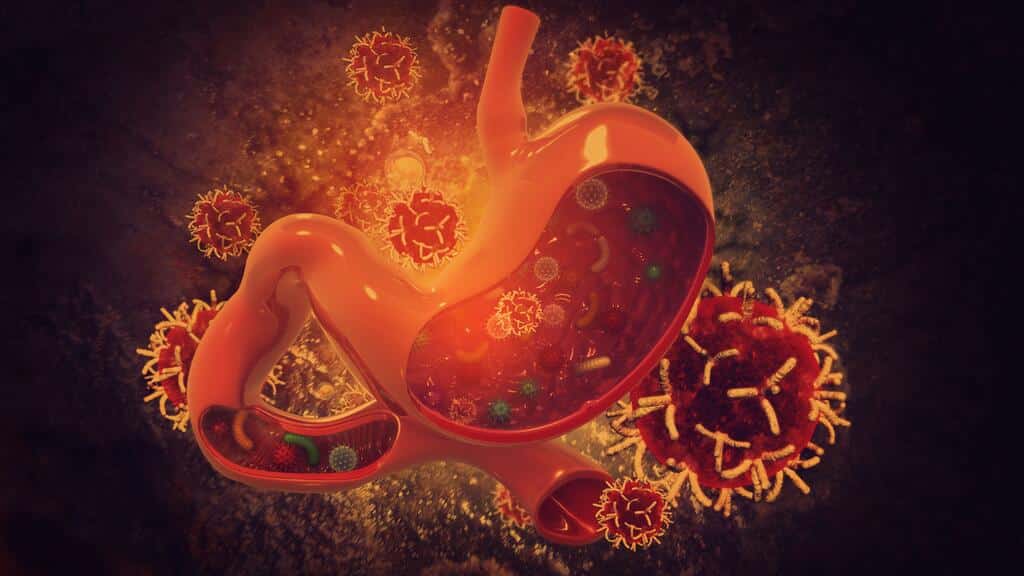Cómo identificar y tratar el cáncer de estómago a tiempo