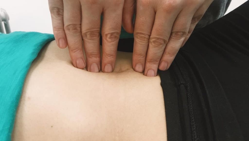 La diástasis de rectos en las mujeres afecta tras el embarazo. 