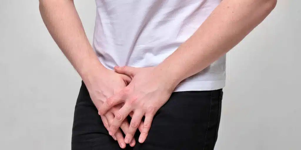 Ilustración comparativa para diferenciar síntomas de hernia inguinal frente a lesiones musculares en la zona de la ingle. Guía informativa para pacientes en Costa Rica sobre cuándo consultar al urólogo o cirujano si presenta dolor intermitente que no cede.