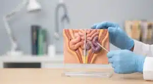 Render anatómico médico fotorrealista que ilustra el compromiso vascular y la restricción del flujo sanguíneo en una hernia inguinal estrangulada en comparación con una encarcelada. Guía de urgencia quirúrgica en Costa Rica para identificar síntomas críticos y saber cuándo consultar inmediatamente a un especialista.